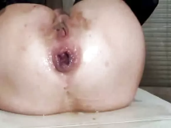 Hole kpɛnngbɛn’m be kunndɛ talua dandan 002.